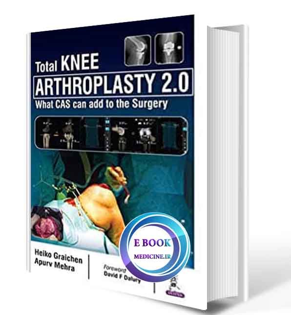 دانلود کتاب total knee arthroplasty 2019 ( PDF)